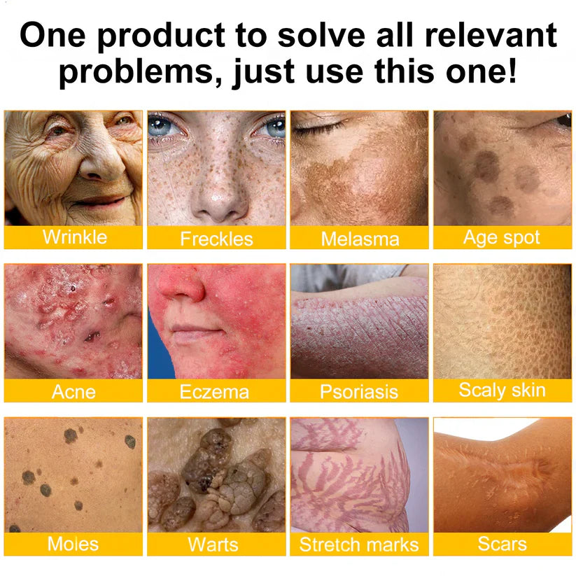 ✨FDA Approved:LOVILDS™ Bee Venom Skin Restoration Cream — 🔥Limited Time 70% OFF🔥 (8963 Reviews)